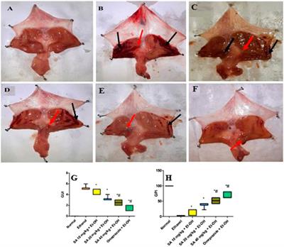 Gastroprotective Effect of Sinapic Acid on Ethanol-Induced Gastric Ulcers in Rats: Involvement of Nrf2/HO-1 and NF-κB Signaling and Antiapoptotic Role